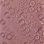 First liposome picture