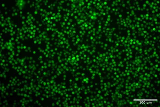 Benchmarking LNP vs Electroporation for eGFP RNA and CRISPR-Cas9 Delivery in HSCs